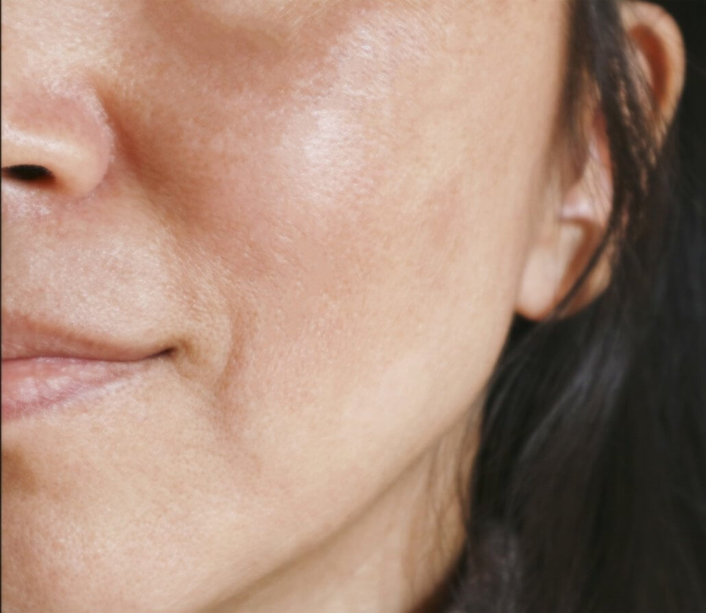 skin care - the woodlands