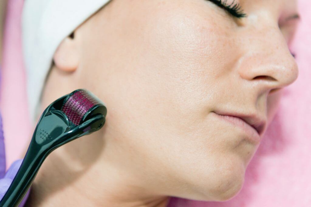 sleek laser facial