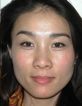 facial care