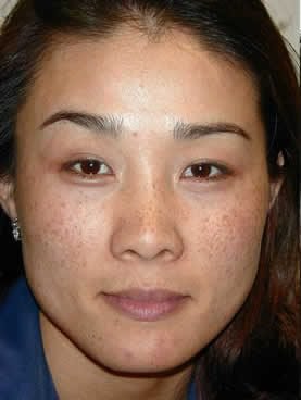 facial care - the woodlands